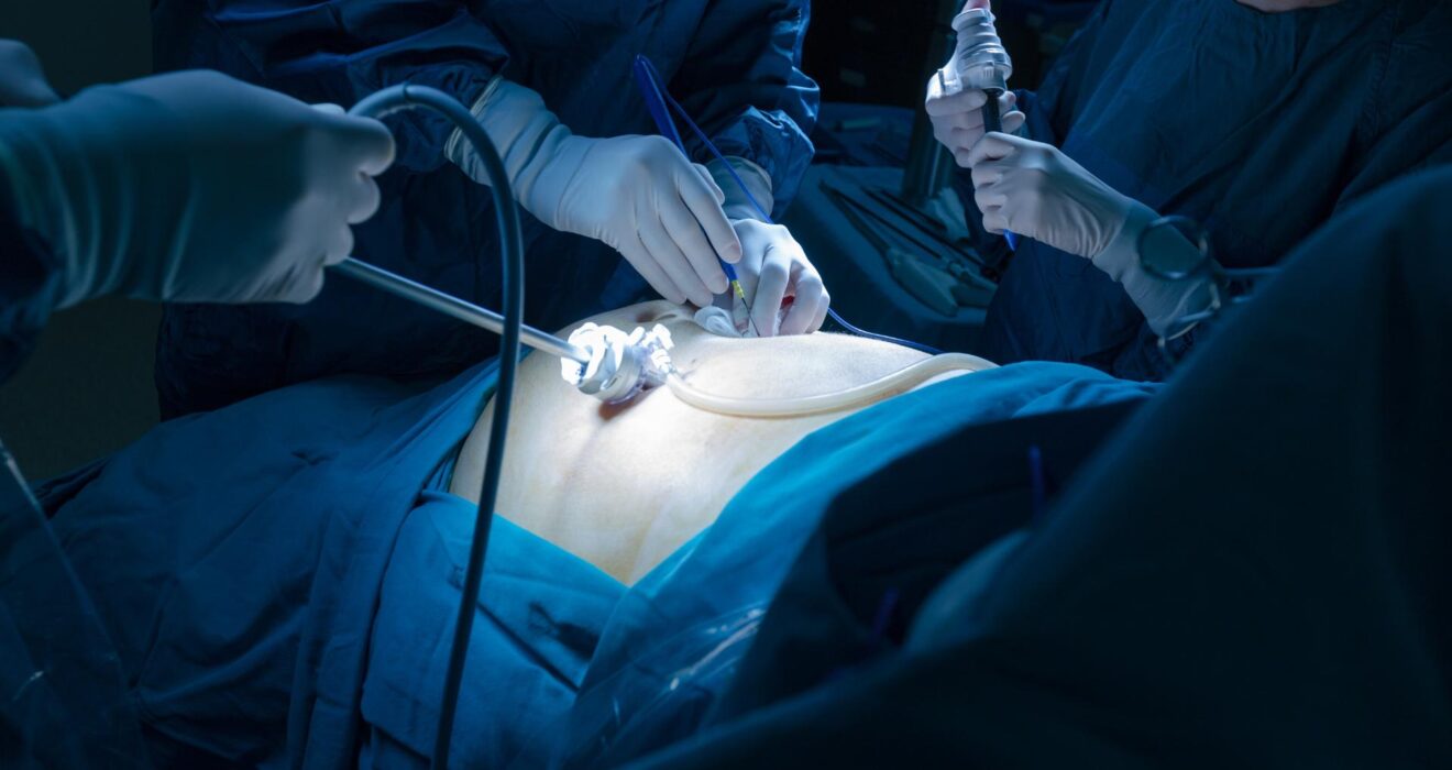 Top Laparoscopic Surgeon in Chandigarh for Hernia, Appendix, and Gallbladder Surgery